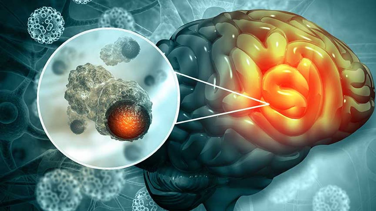Yeni teknolojiler beyin hastalıklarının teşhis ve tedavisini iyileştirecek