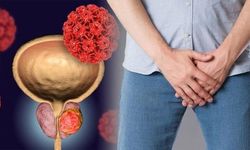 50 Yaşından Sonra Prostat Kontrolünü İhmal Etmeyin!