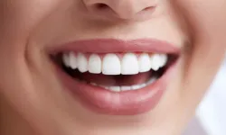 Ünlü Oyuncu Yağmur Tanrısevsin, Sağlıklı Gülüşün Formülünü Verdi