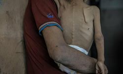İsrail'in insani yardım girişini kısıtladığı Gazze'de bir çocuk daha açlıktan hayatını kaybetti