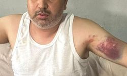 Adana'da dayısı tarafından beyzbol sopasıyla darbedilen kişi yaralandı