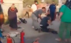 Konteynerde Yangın: 1 Çocuk Yaralandı