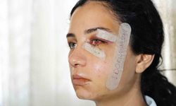 Eski eşini dövüp serbest kalan şüpheli tutuklandı