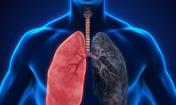 Kronik Obstrüktif Akciğer Hastalığı (KOAH)