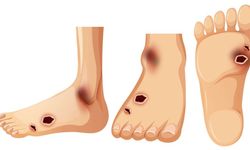 Ayaktaki Küçük Yaralar Büyük Tehlikelerin Habercisi Olabilir