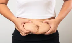 Doğum Kilolarınız Gitti Ama Göbeğiniz Gitmedi mi? Sorun Yağ Değil, "Kas Ayrılması" Olabilir!