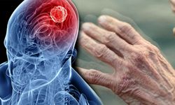 Parkinson Hastalığı Gençleri De Tehdit Ediyor!