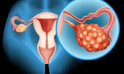 Serviks (Rahim Ağzı) Kanseri Farkındalık Ayı