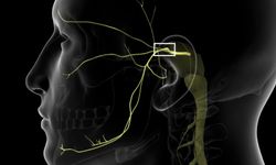 Bu Ağrı, Yemeyi Ve Konuşmayı Önlüyor!