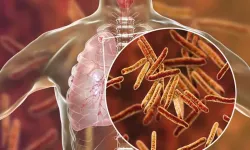 Kahramanmaraş İl Sağlık Müdürlüğünden Verem Haftası Kapsamında Bilgilendirme