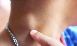 Lenfomanın İlk Sinyali Olabilir!