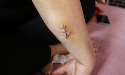 Diyarbakır’da Nikahlı eşini 30 yerinden bıçakladı