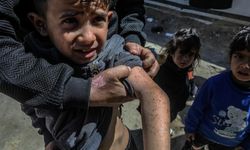 Filistin Sağlık Bakanlığından Gazze'de "salgın hastalık" uyarısı