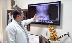 İdrar kanalından 51 taş çıkarıldı