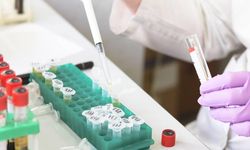 Gıda ve çevre konulu uluslararası projelere destek sağlanacak