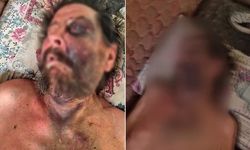 Akılalmaz Olay! “Cenazeye Neden Gelmedin?” Diyerek Dövüp Metruk Eve Bıraktılar