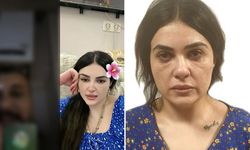 215 Suç Kaydı Bulunan Kadın Canlı Yayında Yakalandı!