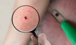 Yeni Virüs Tespit Edildi! Belirtileri Şaşırttı