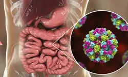 Norovirüs Nedir, Nasıl Bulaşır? Belirtileri Nelerdir?