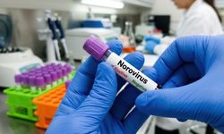 Norovirüs Nedir, Öldürür Mü? Bulaşma Yolları ve Belirtileri