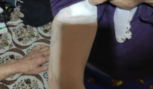 Burdur'da sahipsiz köpeklerin saldırdığı kadın yaralandı