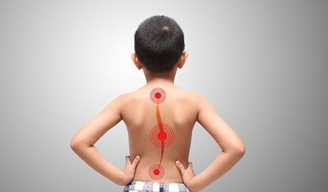 Skolyoz Çocuğunuzun Sağlıklı Ve Hareketli Büyümesini Engellemesin