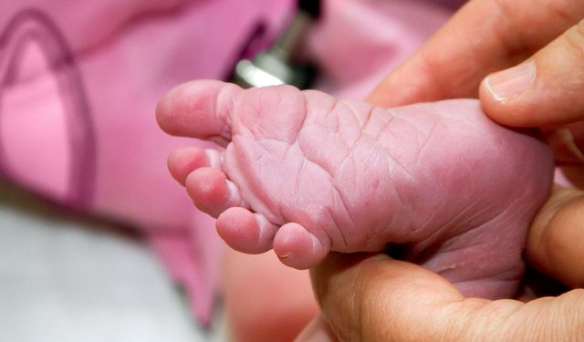 Türkiye’de Her 25 Kişiden Biri Fenilketanüri Hastalığının Taşıyıcısı