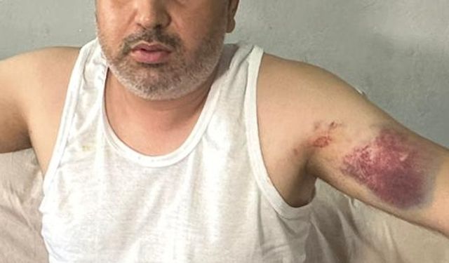 Adana'da dayısı tarafından beyzbol sopasıyla darbedilen kişi yaralandı
