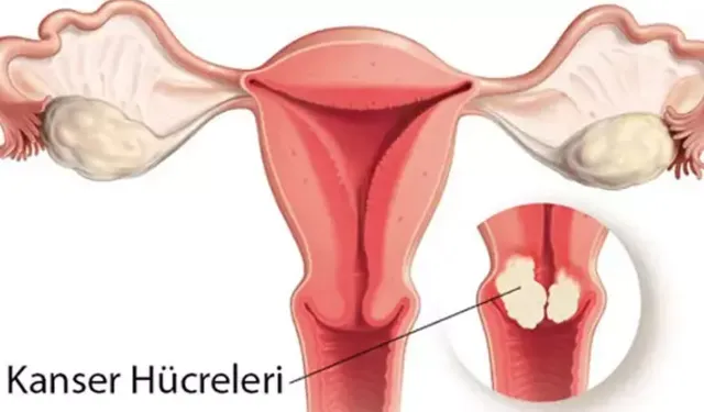 Rahim Ağzı Kanserinde İlk ve En Güçlü Tedavi: Farkındalık