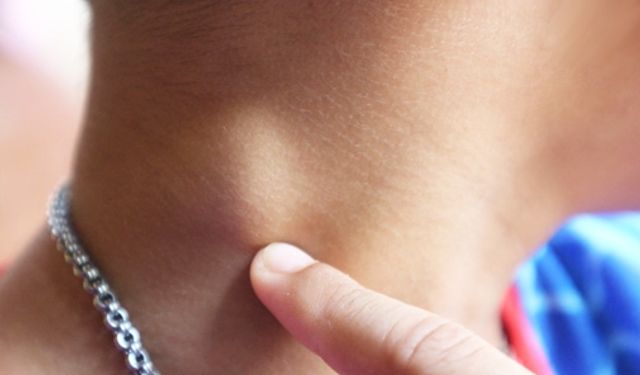 Lenfomanın İlk Sinyali Olabilir!