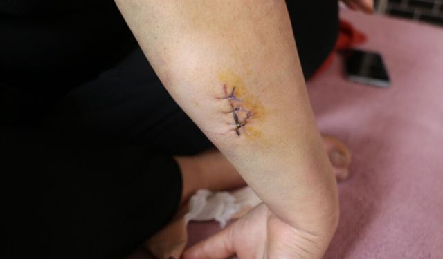 Diyarbakır’da Nikahlı eşini 30 yerinden bıçakladı