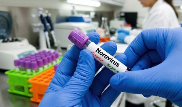 Norovirüs Nedir, Öldürür Mü? Bulaşma Yolları ve Belirtileri