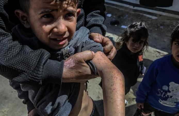 Filistin Sağlık Bakanlığından Gazze'de "salgın hastalık" uyarısı