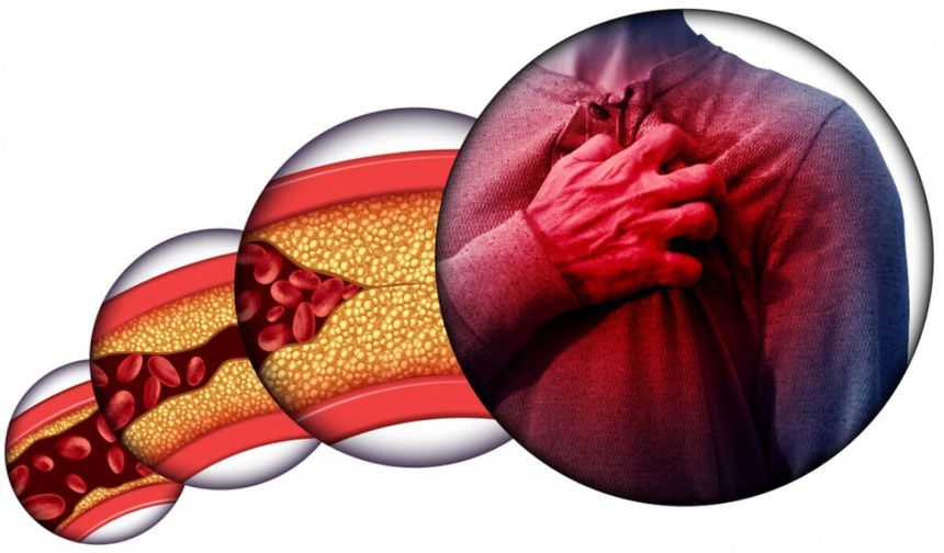 Portakalı Tahtından Eden Meyve! C Vitamini Deposu, Kolajen Üretimini Destekliyor ve Kalp Sağlığına Katkı Sağlıyor