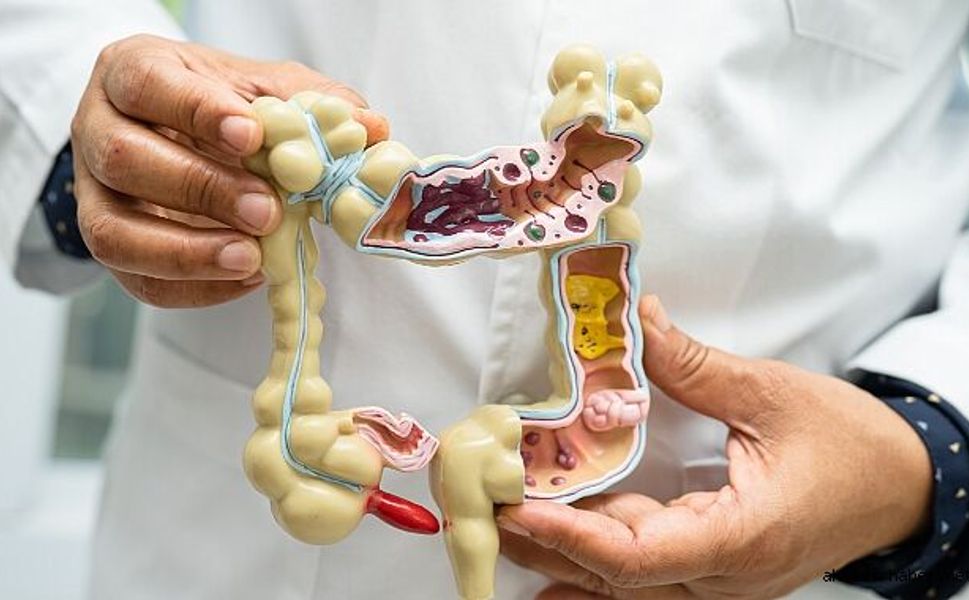 Mart Ayı Kolorektal Kanserine Karşı Farkındalık Ayı