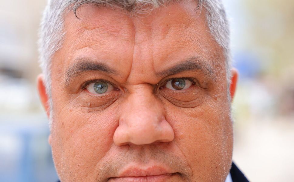 Bir Gözü Mavi, Diğeri İki Renk: Kahramanmaraş’ta İlginç Bir Hikâye