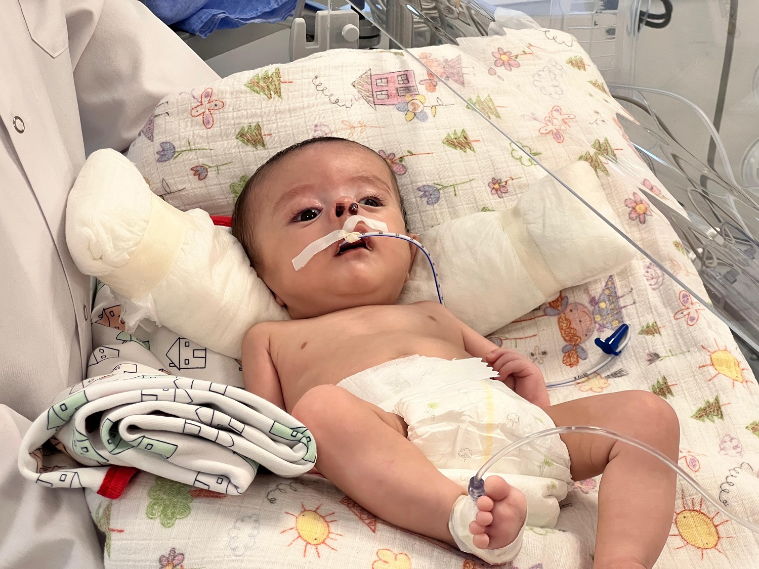 Sol Burun Deliği Olmayan Bebek Artık Daha Rahat Nefes Alacak (4)