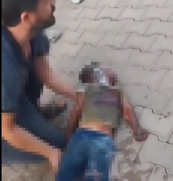 Konteynerde Yangın 1 Çocuk Yaralandı 1