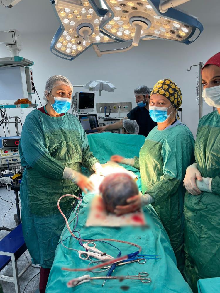 Operasyona Alınan Hastanın Karnından 'Dev Tümör' Çıktı 1