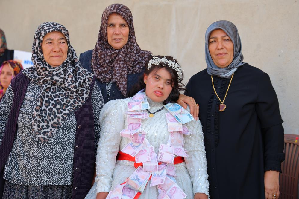 Down Sendromlu Melek'in Gelinlik Hayali Gerçek Oldu 7