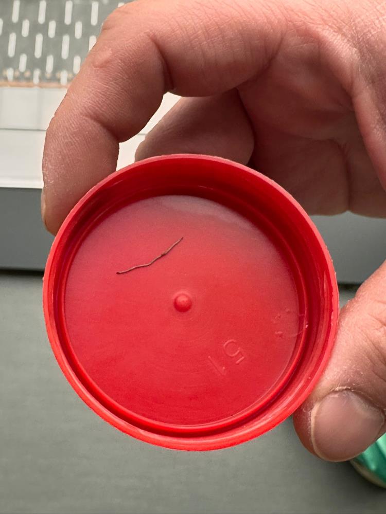 Bebeğin Sırtından Çıkan Tel Parçası Şoke Etti 4