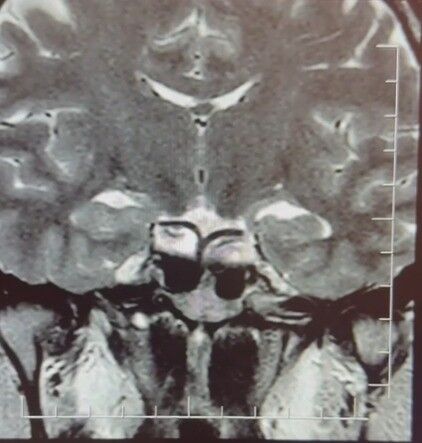 Hamileyim Diye Geldi, Tümör Teşhisi Konuldu (3)