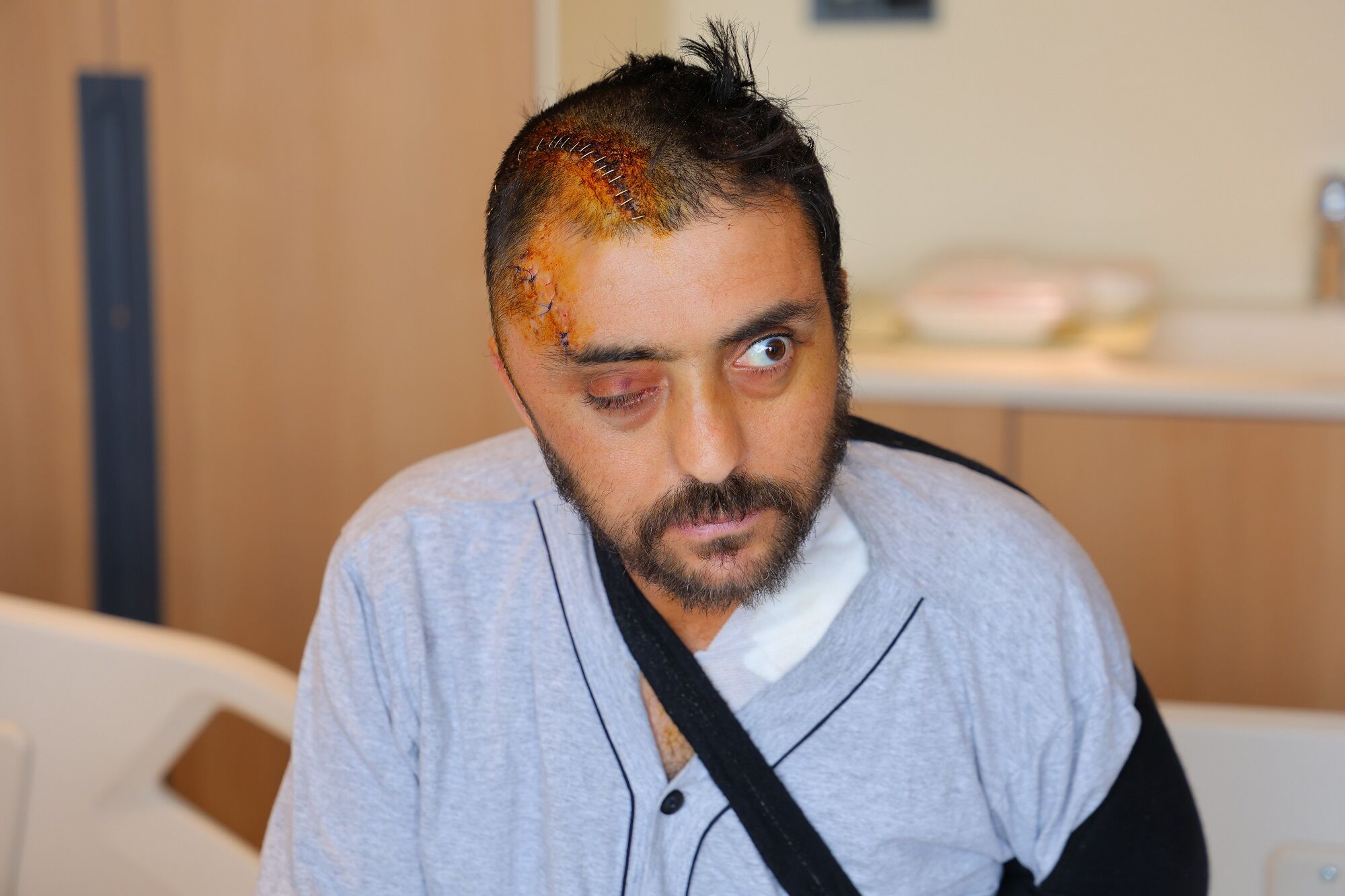 Kafasına Kaya Düşen Genç Sürücü Başarılı Ameliyatla Sağlığına Kavuştu (4)