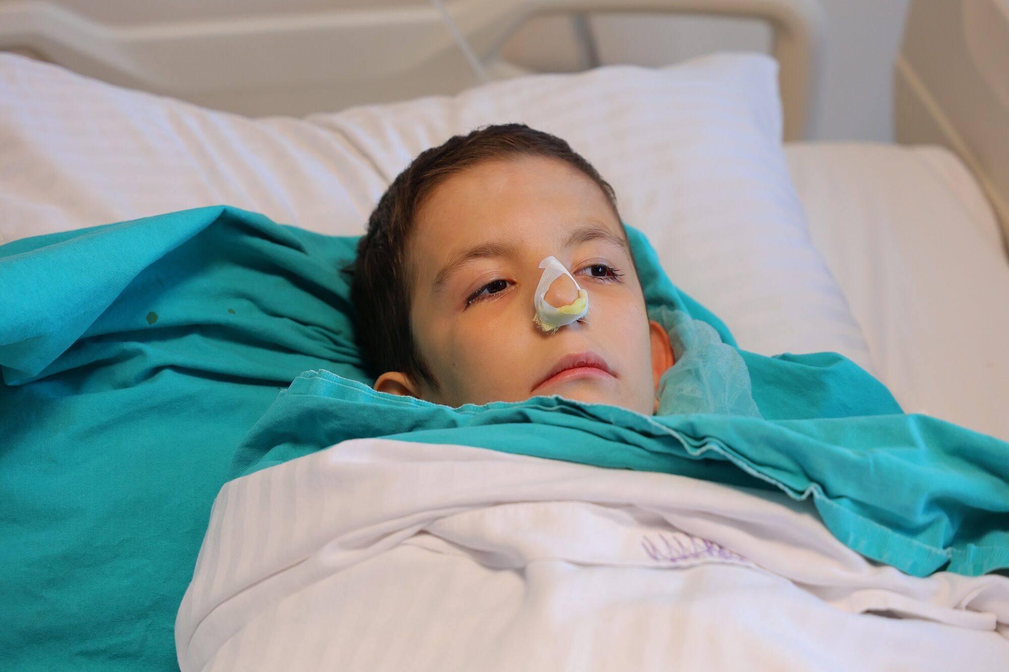 Burun Tıkanıklığı Şikayetiyle Gitti, Genizden Dev Polip Çıktı (3)